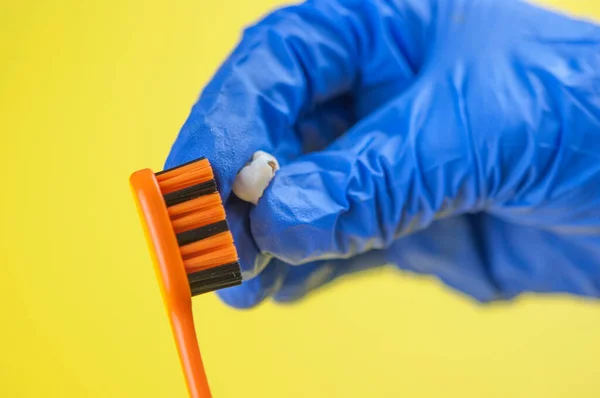 Escova Dentes Leite Decíduo Dentes Criança Fundo Amarelo — Fotografia de Stock