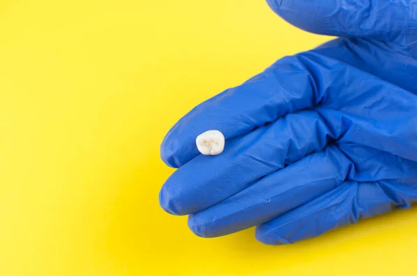 Ząb Mleczny Dla Dzieci Jest Niebieskich Rękawiczkach Medycznych — Zdjęcie stockowe