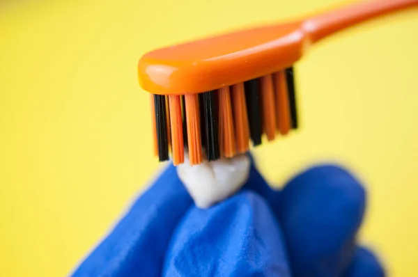 Tooth Brush Deciduous Milk Child Teeth Yellow Background — Stock Photo, Image