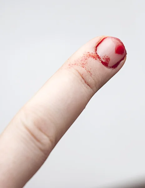 Finger prick — Stockfoto