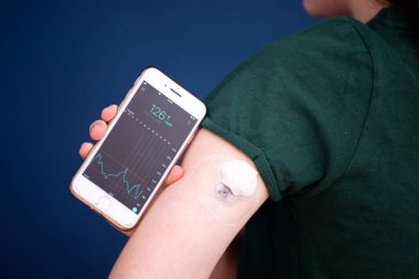 Kız uzaktan algılayıcı ve cep telefonuyla glikoz seviyesini kontrol ediyor. Sürekli glikoz monitörü.