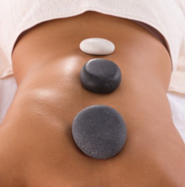 Kaplıca ameliyatı olan genç bir kadın..