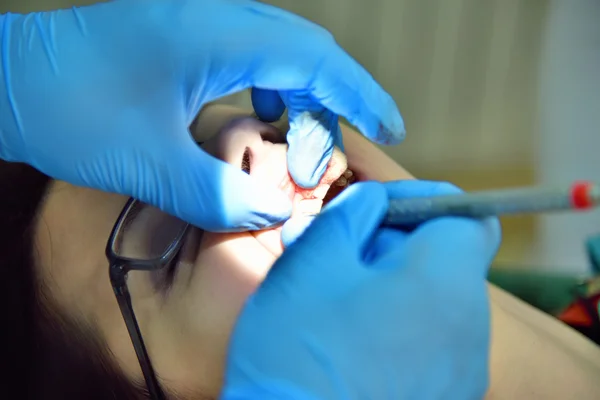 Dentista realizando uma operação — Fotografia de Stock