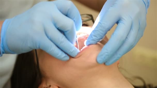 Οδοντίατρος τη διεξαγωγή μιας λειτουργίας στο στόμα — Αρχείο Βίντεο