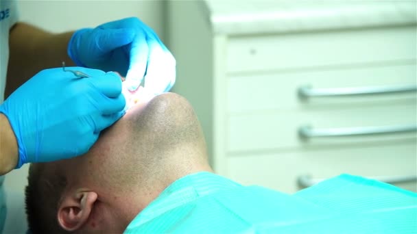 Dentista instala implante nos dentes dianteiros. Fecha. Efeito de movimento lento — Vídeo de Stock