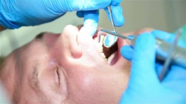 Diş hekimi diş sonda ve ayna incelenmesi.