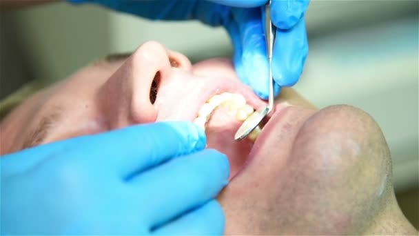 Primer plano de la boca del hombre con espejo en el dentista — Vídeos de Stock