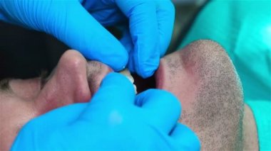 Mavi eldiven diş hekimi diş Implant hasta koyar