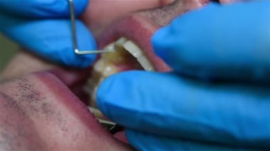 Diş hekimi, diş incelenmesi