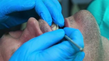 diş hekimi temizler