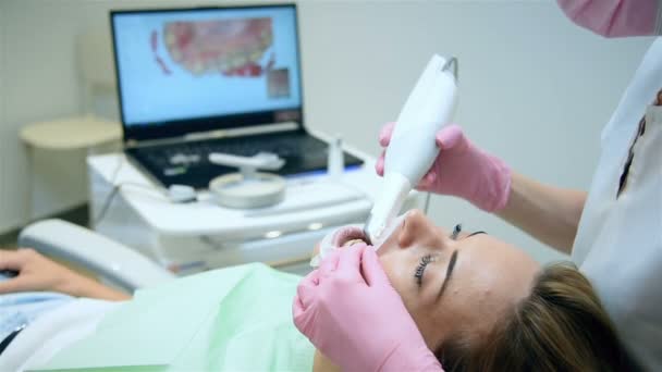 Denti Del Paziente Scansione Dentistica Con Scanner Intraorale Dentale Sanità — Video Stock