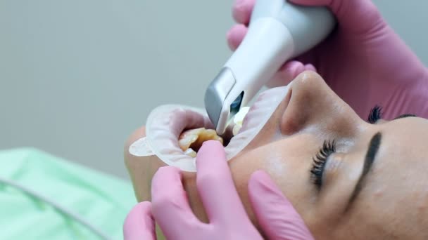 Dentista Que Escanea Los Dientes Del Paciente Con Máquina Escaneo — Vídeos de Stock