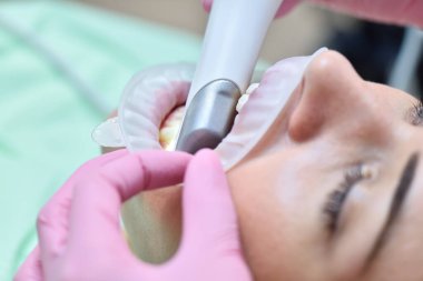 Diş hekimi diş taraması için 3 boyutlu intraoral tarayıcı kullanıyor. Modern dişçilik ve sağlık hizmetleri konsepti. Kapat.