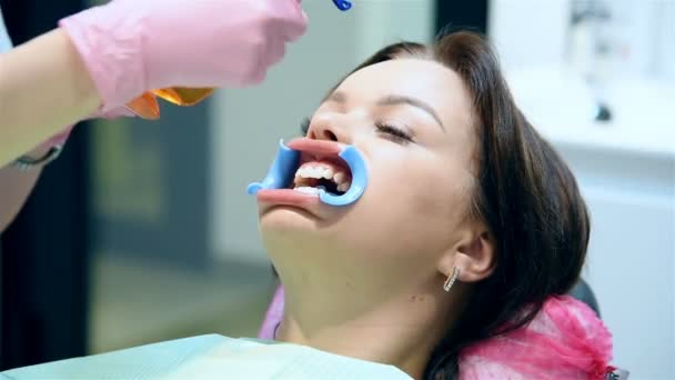 Dentista Prepara Paciente Para Procedimiento Blanqueamiento Dental Dental Teeth Whitening — Vídeos de Stock