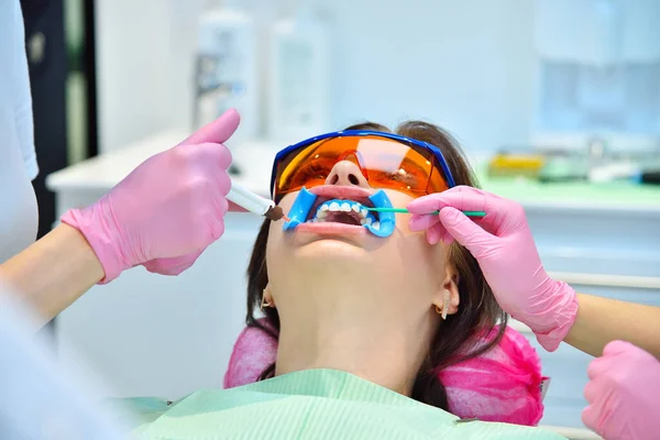 Wybielanie Zębów Dla Kobiety Klinice Dentystycznej Koncepcja Wybielania Zębów Zębów — Zdjęcie stockowe