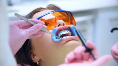 Diş Hekimi Diş Beyazlatma Prosedürü Kadın Hastasını Diş Kliniğine Hazırlıyor. Yavaş Hareket Etkisi. Kapat.