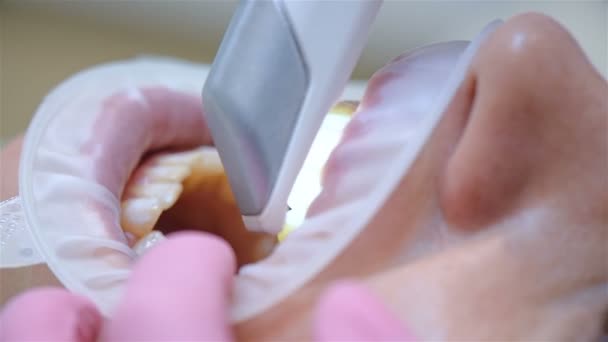 Denti Del Paziente Scansione Ortodontista Con Scanner Intraorale Dentale Clinica — Video Stock