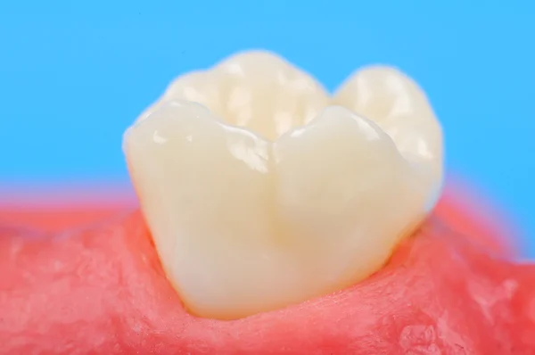 Tooth — Stock Photo, Image