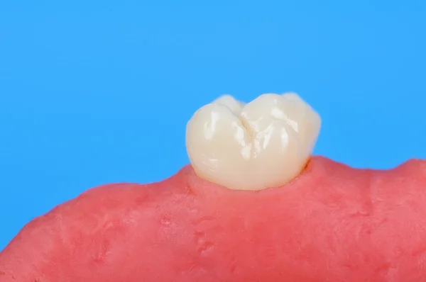 Zub v guma — Stock fotografie