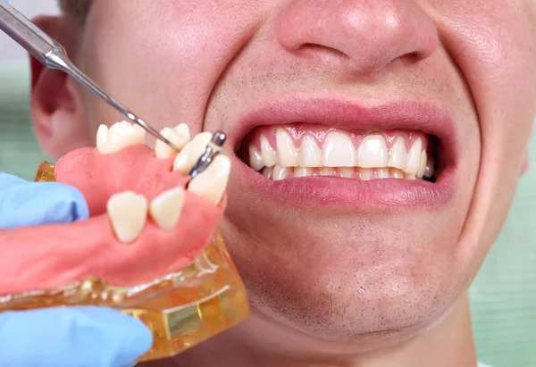 Tandläkare visar implantatet — Stockfoto