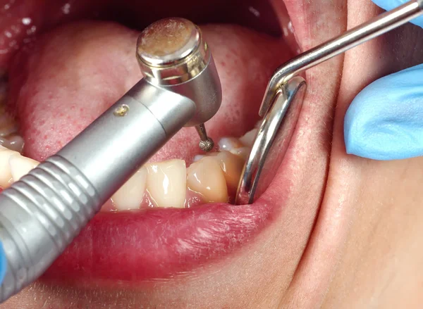 Sağlıklı bir insan dişler