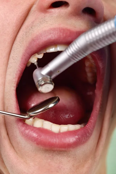 Dentist makes process of treatment — Stock Photo, Image