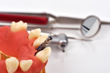 jaw bone and dental tools