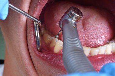 Sağlıklı bir insan dişler