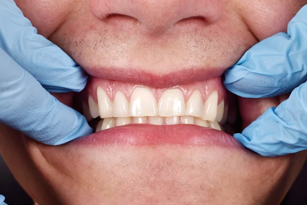 Dentista mostra os dentes de um paciente — Fotografia de Stock
