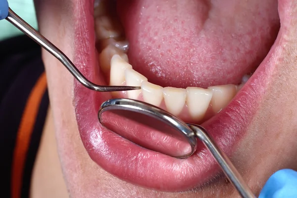 Pacjenta otwarte usta — Zdjęcie stockowe