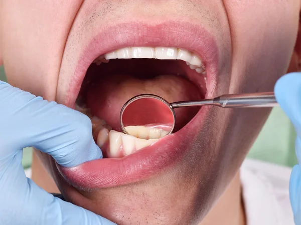 Dentista examinando los dientes del paciente — Foto de Stock