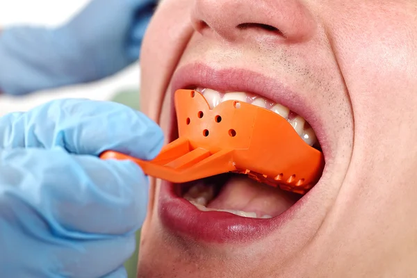 Dentista inserta cuchilla — Foto de Stock