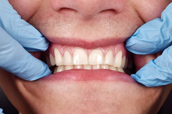 Dentist shows a patient's teeth 로열티 프리 스톡 사진