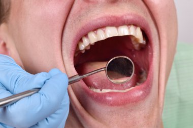 Diş hekimi muayene hastanın diş