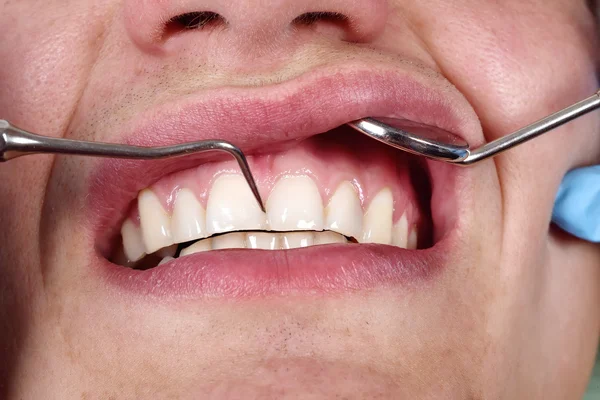 Patient having her teeth examined by specialist — 图库照片