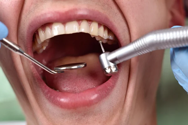 Mutilar Esperar Exactitud Dentist using dental drill fotos de stock, imágenes de Dentist using dental  drill sin royalties | Depositphotos