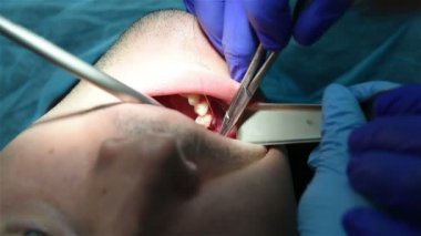 Diş Hekimi sakız diker