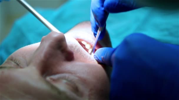 Dentista quita el diente — Vídeo de stock