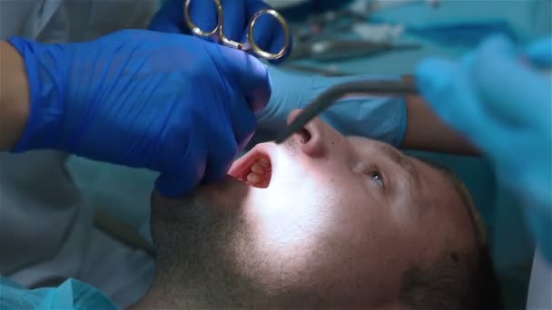 Suture dentistiche gomma — Video Stock
