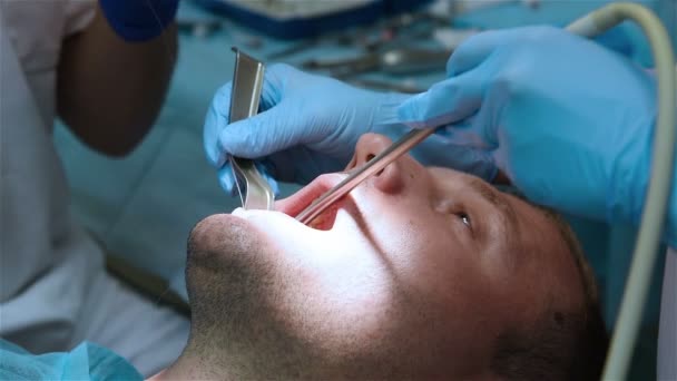 Zubař stehy guma — Stock video