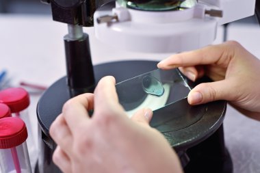 örnekleri ve sıvı incelenmesi