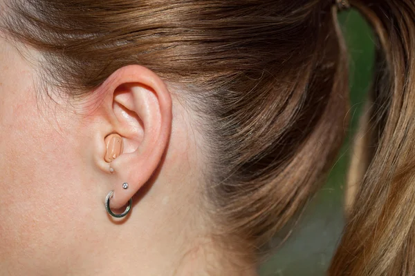 Girl with a hearing aid. hearing aid in the ear close up