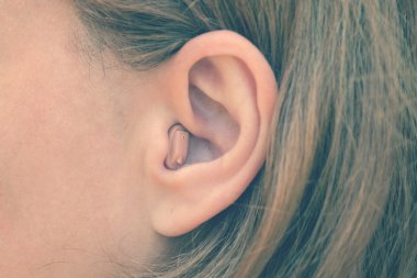 Tıbbi cihaz işitme. Kızın kulağına işitme yardımcısıdır