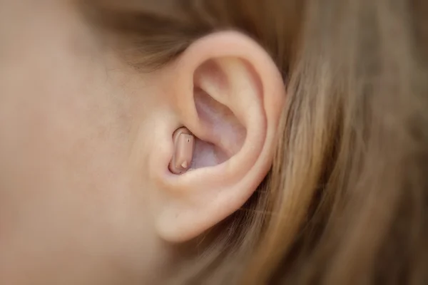 Hearing aid in your ear close-up. Modern equipment in medicine — Stock Photo, Image