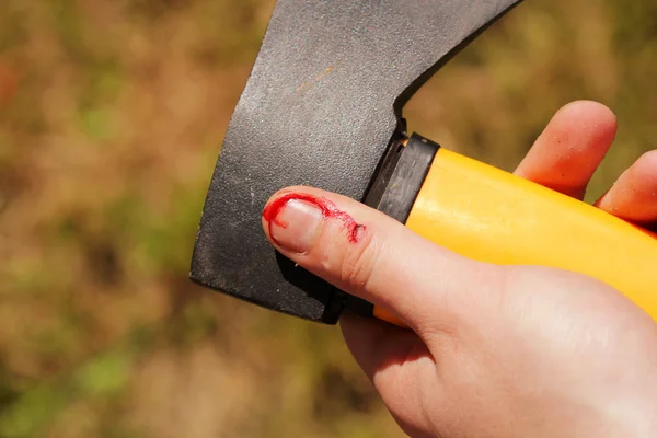 Work Accident — Stock Photo, Image