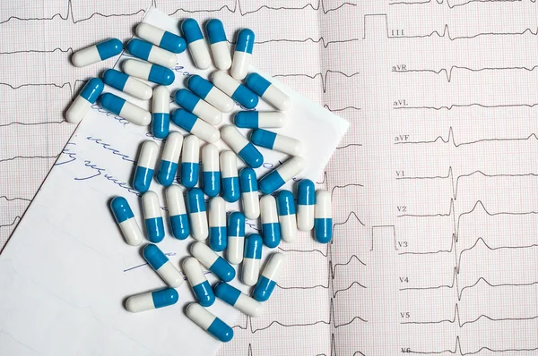 在心电图上片 — 图库照片