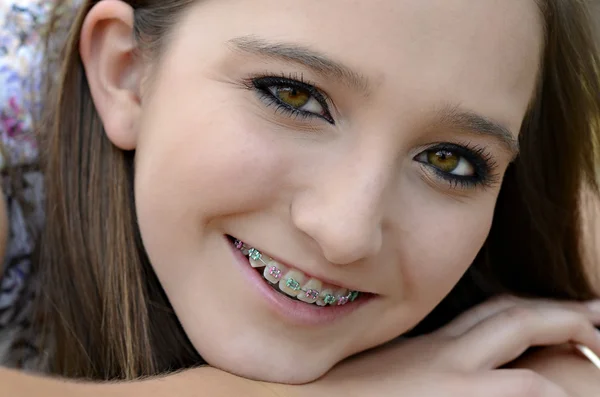 Pretty Teen with Braces — Stock Photo, Image