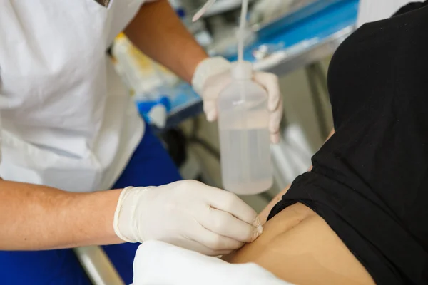 Preparação para injeção de estômago no hospital — Fotografia de Stock