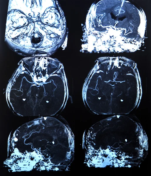 Röntgen görüntüleri kümesi — Stok fotoğraf