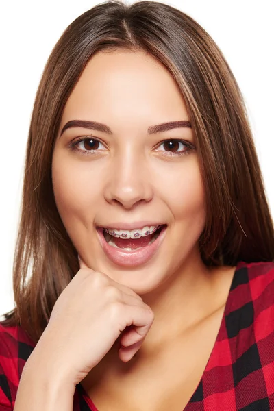 Підліток-жінка посміхається з брекетами на зубах — стокове фото
